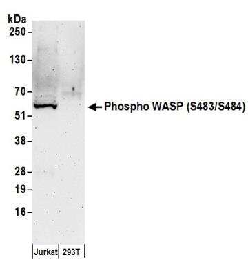 Western Blot: WASP [p Ser483, p Ser484] Antibody [NB100-2307] - Detection of Human Phospho WASP (S483/S484) by Western Blot. Samples: Whole cell lysate (50 ug) from Jurkat and 293T cells prepared using NETN lysis buffer. Antibody: Affinity purified rabbit anti-Phospho WASP (S483/S484) antibody NB100-2307 used for WB at 0.1 ug/ml. Detection: Chemiluminescence with an exposure time of 3 minutes.